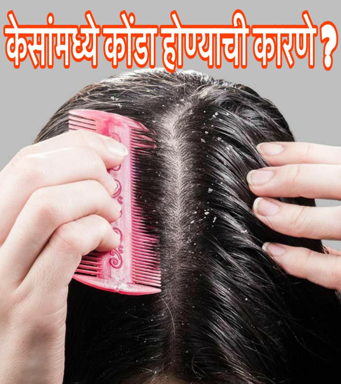 Dandruff home remedies in Marathi 