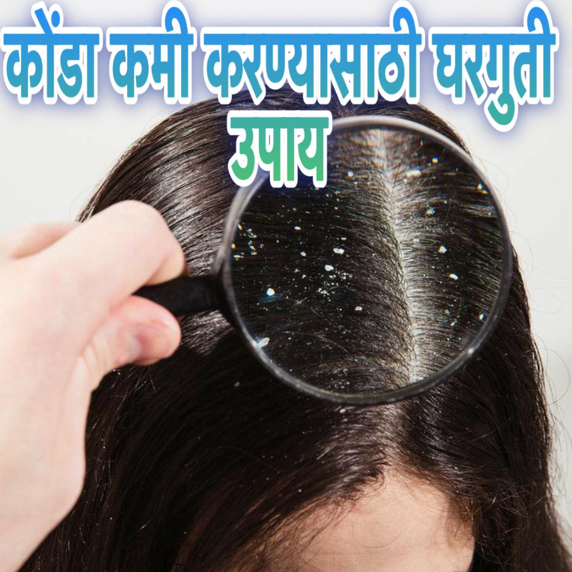 Dandruff home remedies in Marathi 